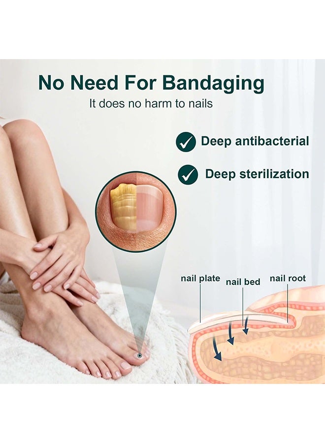 EELHOE Fungal Treatment Solution, Anti Fungal Nail Repair Pen, Nail Fungus Nursing Liquid, Daily Hands And Feet, Nail Care, Nail Lotion, Thickening Soft Nails, Fungal Nail Repair Pen For Nail Damage, 3ml - Image 4